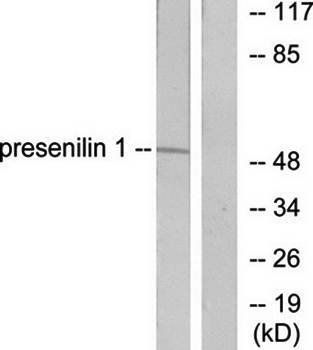 Presenilin 1 antibody