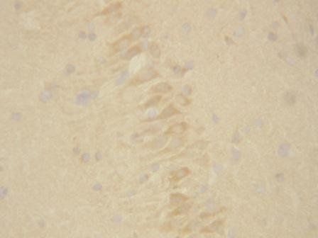 Anti-Presenilin 2/PSEN2 Antibody