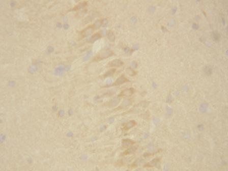 Presenilin 2/PSEN2 Antibody