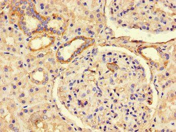 PREX2 Antibody