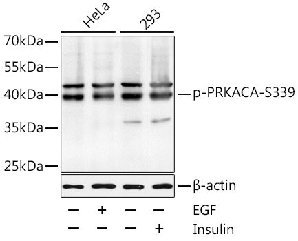 PRKACA (Phospho-S339) antibody