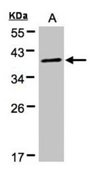 PRKACA antibody