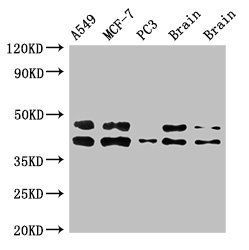 PRKACB Antibody