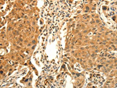 PRKACG Antibody