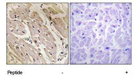 PRKAG2 Antibody