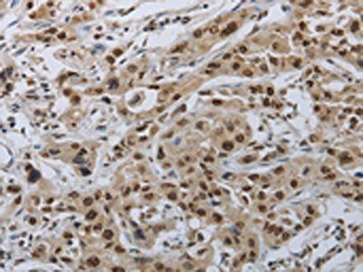 PRKAR1B Antibody