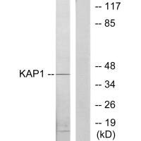 PRKAR1B Antibody