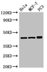 PRKAR2A Antibody