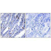 PRKAR2B (Ab-113) Antibody