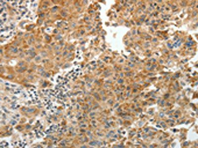 PRKCA Antibody