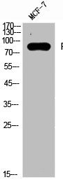 PRKCA/PRKCB/PRKCD/PRKCE/PRKCG/PRKCH/PRKCQ/PRKCZ Antibody
