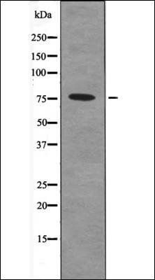 PRKCA (Phospho-Ser657) antibody