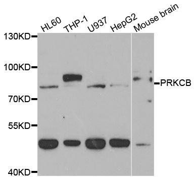 PRKCB antibody
