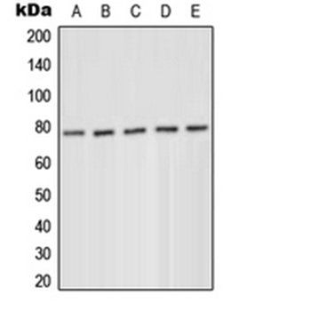 PKC delta (phospho-Y52) antibody