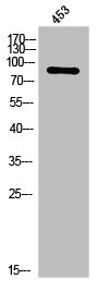 PRKCE Antibody