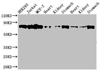 PRKCH Antibody