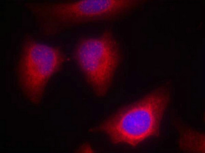 PRKCQ (Ab-676) antibody