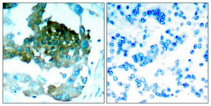 PRKCQ (Ab-695) Antibody