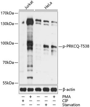 PRKCQ (Phospho-T538) antibody
