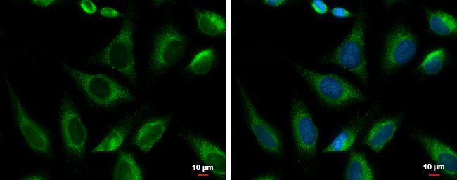 PRKCSH antibody