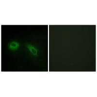 PRKCSH Antibody