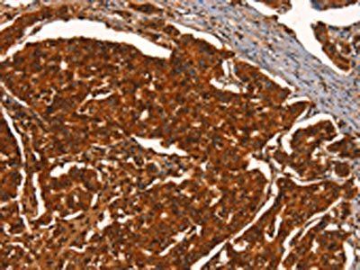 PRKD1 Antibody