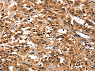 PRKD1 Antibody
