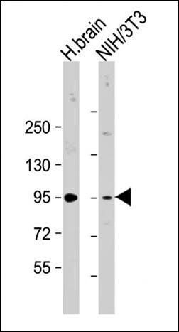 PRKD2 antibody