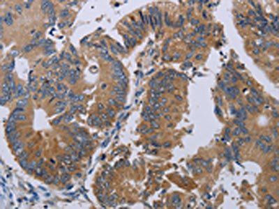 PRKD3 Antibody