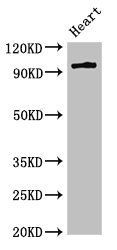 PRKD3 antibody