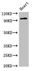 PRKD3 Antibody