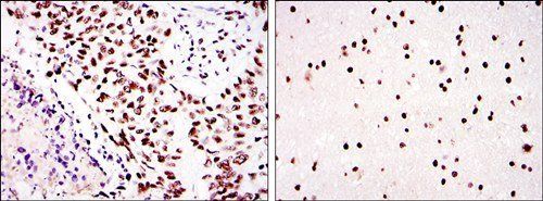 PRKDC Antibody