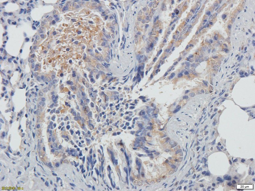 PRKG2 Rabbit Polyclonal Antibody