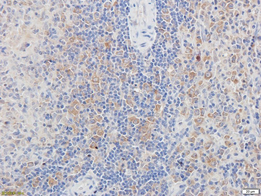 PRKG2 Rabbit Polyclonal Antibody