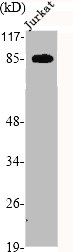 PRKG2 Antibody