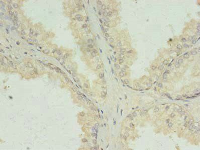 PRKRA Antibody