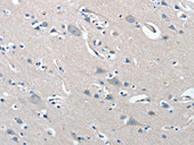 PRKX Antibody
