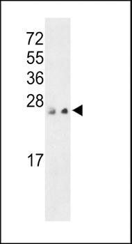 PRL3 antibody