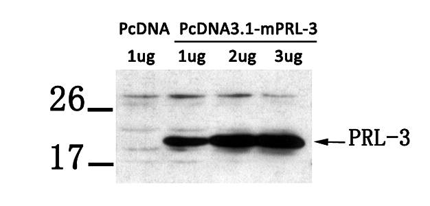 PRL-3 Antibody