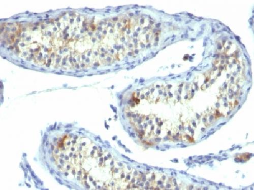 Prolactin Receptor (hPRL Receptor) Antibody