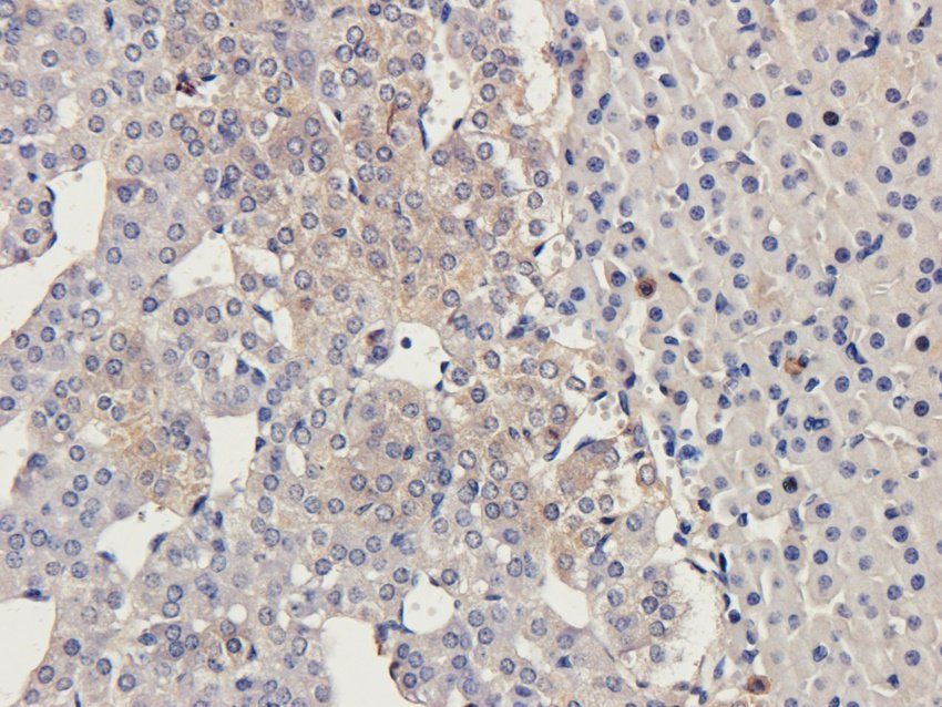 PRLR Rabbit Polyclonal Antibody