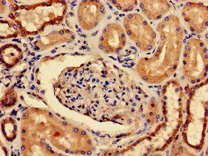 PRLR Antibody