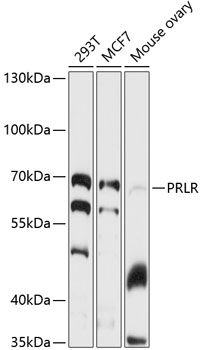 PRLR antibody