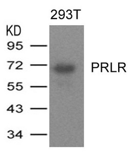 PRLR antibody