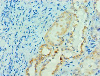 PRMT1 Antibody