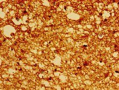 PRMT1 Antibody