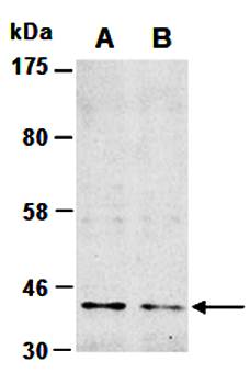 PRMT1 antibody