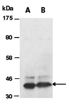 PRMT1 (C) Antibody, Rabbit Polyclonal