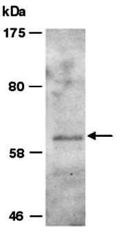 PRMT3 antibody