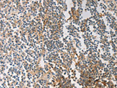 PRMT5 Antibody